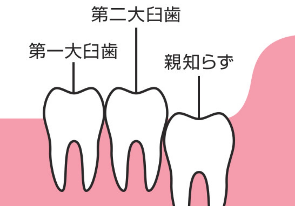 01. 正常に生えているタイプ