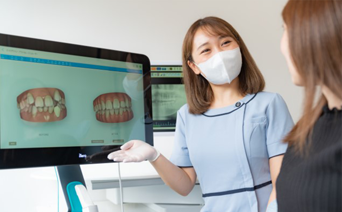 口腔内スキャナー「iTero」の写真