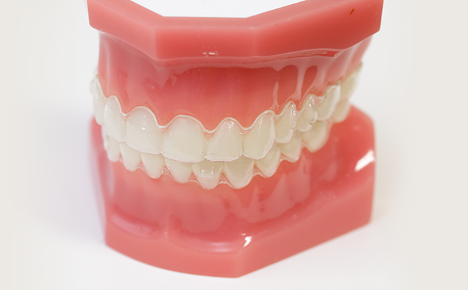 マウスピース矯正の見本の写真