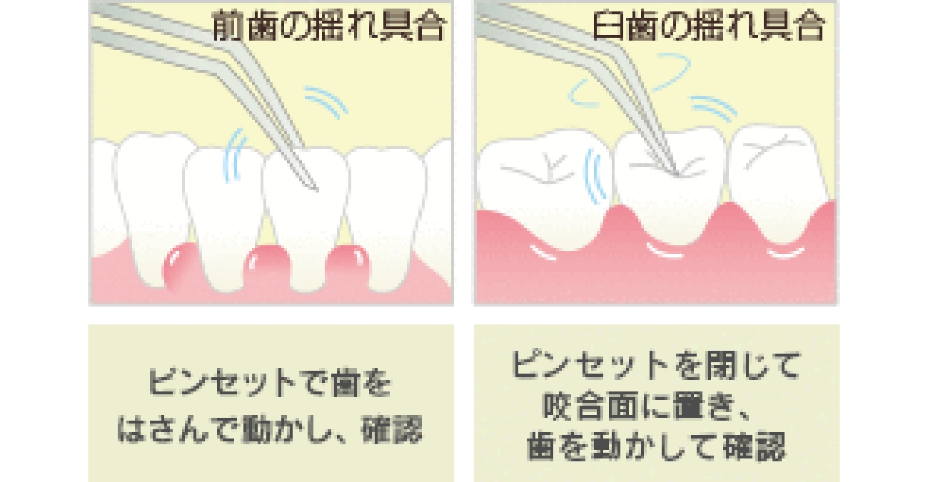 動揺度の測定