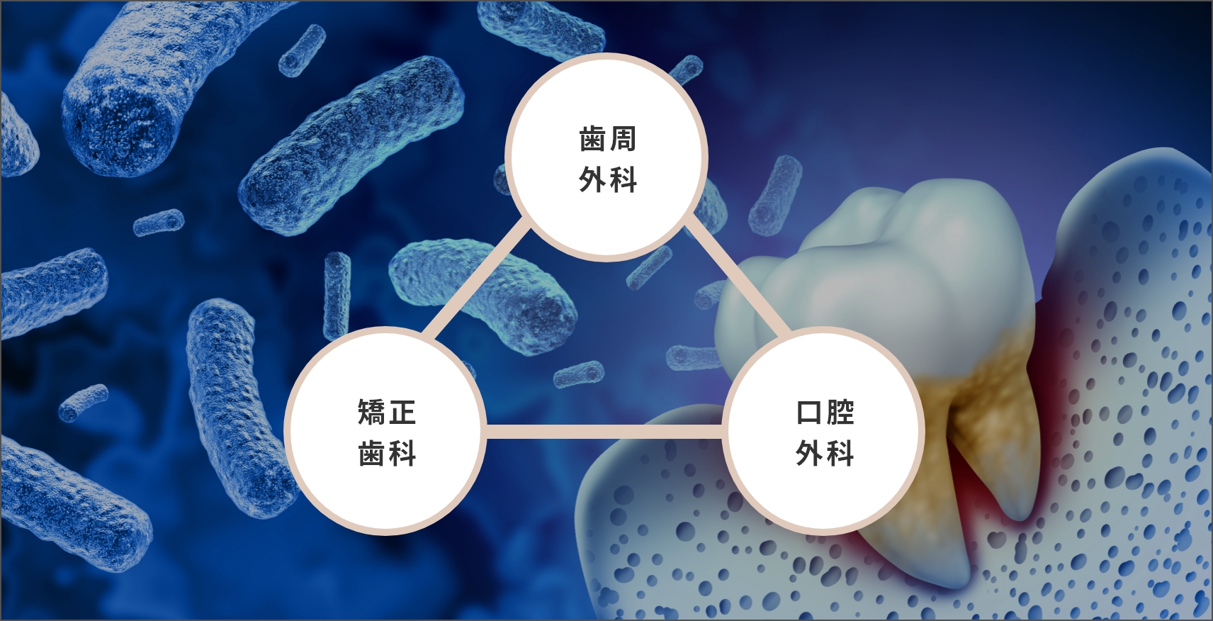 トライアングル医療で歯周病をブロック