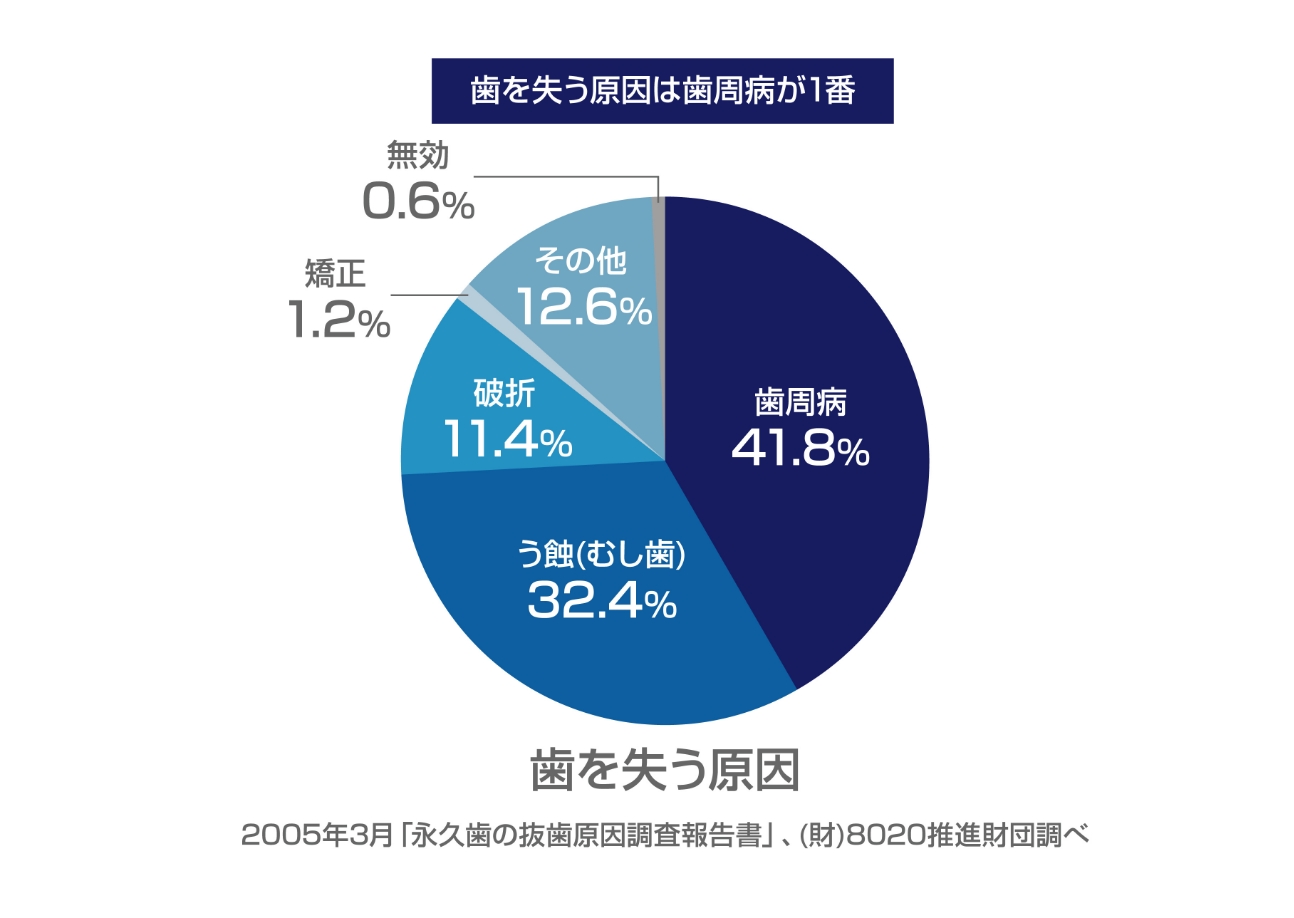 歯周病は永久歯を失う理由のNo.1