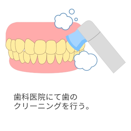 ホームホワイトニングの流れ