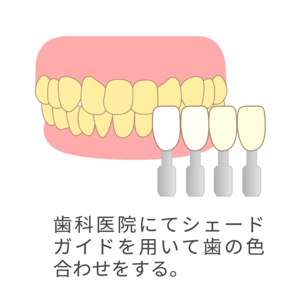 オフィスホワイトニングの流れ